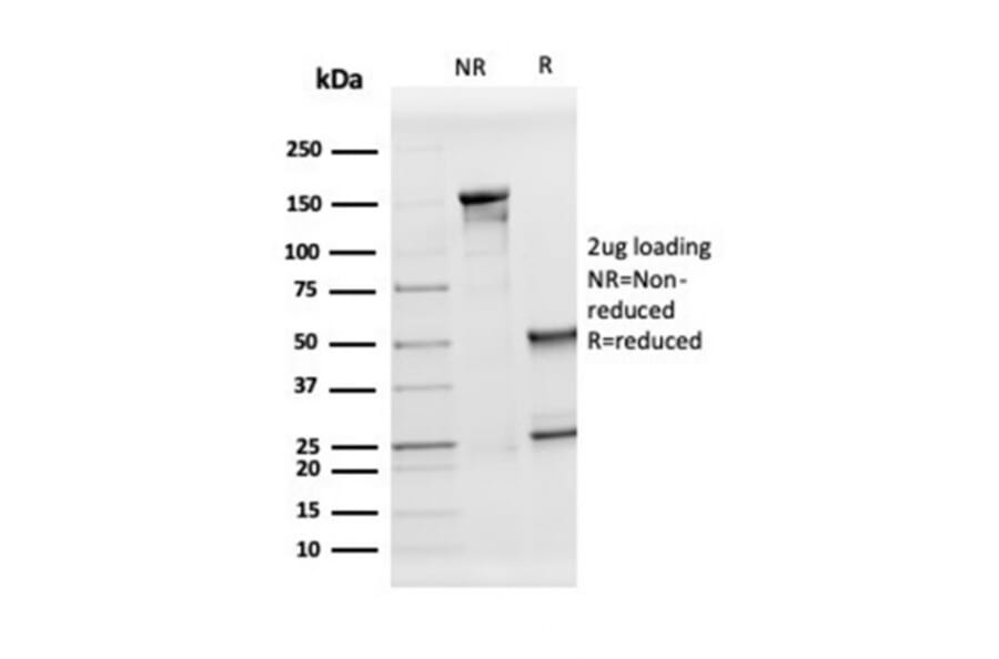 SDS-PAGE - Anti-Apolipoprotein D Antibody [APOD/3413] - BSA and Azide free (A278242) - Antibodies.com
