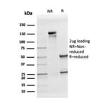 SDS-PAGE - Anti-Apolipoprotein D Antibody [APOD/3413] - BSA and Azide free (A278242) - Antibodies.com
