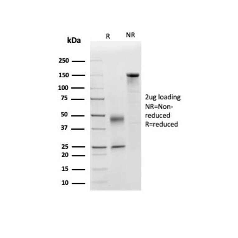 SDS-PAGE - Anti-Apolipoprotein D Antibody [APOD/3415] - BSA and Azide free (A278243) - Antibodies.com