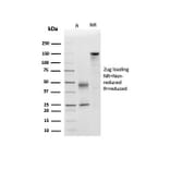 SDS-PAGE - Anti-Apolipoprotein D Antibody [APOD/3415] - BSA and Azide free (A278243) - Antibodies.com