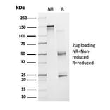 SDS-PAGE - Anti-ZNF81 Antibody [PCRP-ZNF81-2C7] - BSA and Azide free (A278244) - Antibodies.com