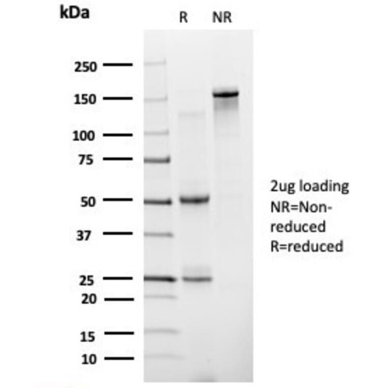 SDS-PAGE - Anti-ZNF81 Antibody [PCRP-ZNF81-2G2] - BSA and Azide free (A278245) - Antibodies.com