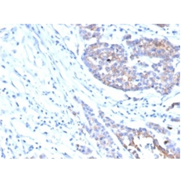 Immunohistochemistry - Anti-IGF1 Receptor Antibody [IGF1R/4667] - BSA and Azide free (A278247) - Antibodies.com