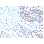 Immunohistochemistry - Anti-IGF1 Receptor Antibody [IGF1R/4667] - BSA and Azide free (A278247) - Antibodies.com