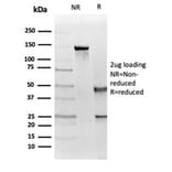 Immunohistochemistry - Anti-IGF1 Receptor Antibody [IGF1R/4667] - BSA and Azide free (A278247) - Antibodies.com