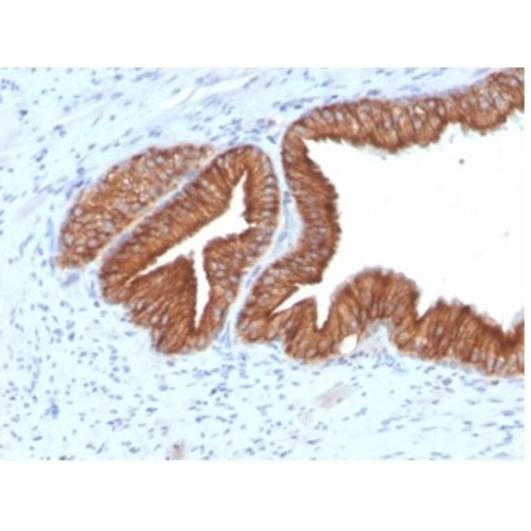 SDS-PAGE - Anti-IGF1 Receptor Antibody [IGF1R/4667] - BSA and Azide free (A278247) - Antibodies.com