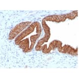 SDS-PAGE - Anti-IGF1 Receptor Antibody [IGF1R/4667] - BSA and Azide free (A278247) - Antibodies.com