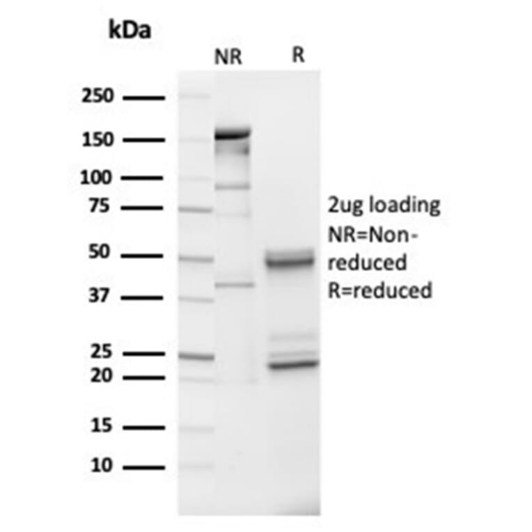 SDS-PAGE - Anti-IGFBP3 Antibody [IGFBP3/3517] - BSA and Azide free (A278249) - Antibodies.com