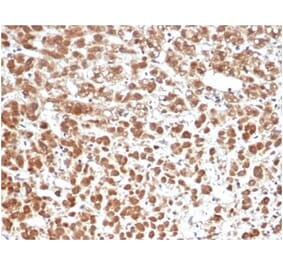 Immunohistochemistry - Anti-IL-1 beta Antibody [IL1B/6687] - BSA and Azide free (A278250) - Antibodies.com