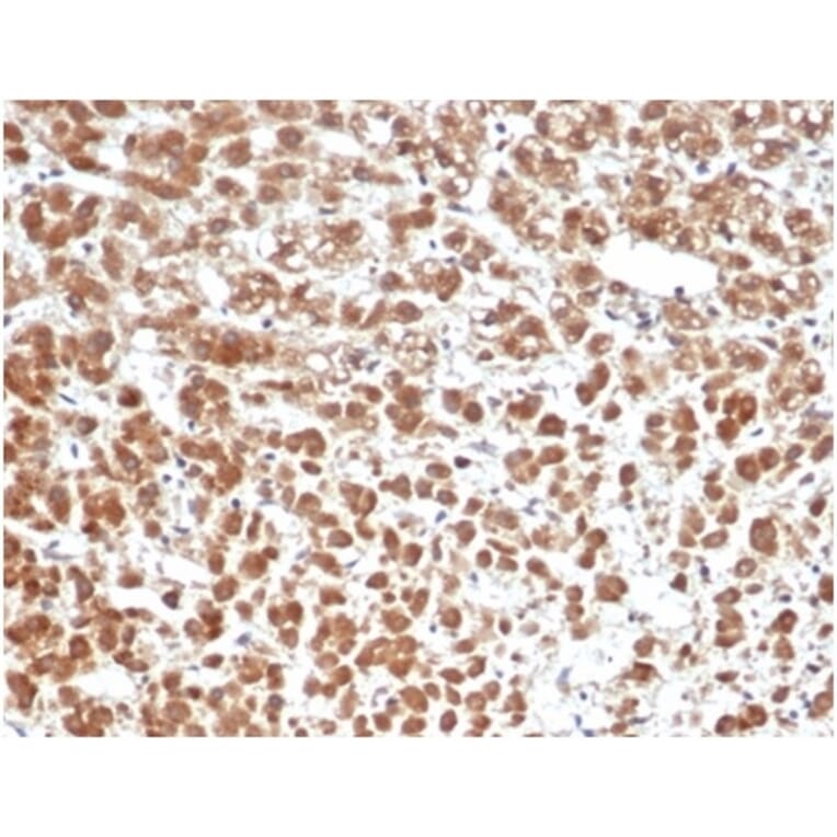 Immunohistochemistry - Anti-IL-1 beta Antibody [IL1B/6687] - BSA and Azide free (A278250) - Antibodies.com