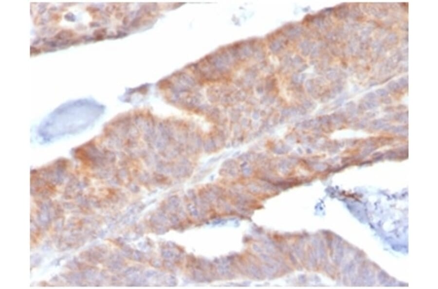 Immunohistochemistry - Anti-IL-1 beta Antibody [IL1B/3993] - BSA and Azide free (A278251) - Antibodies.com