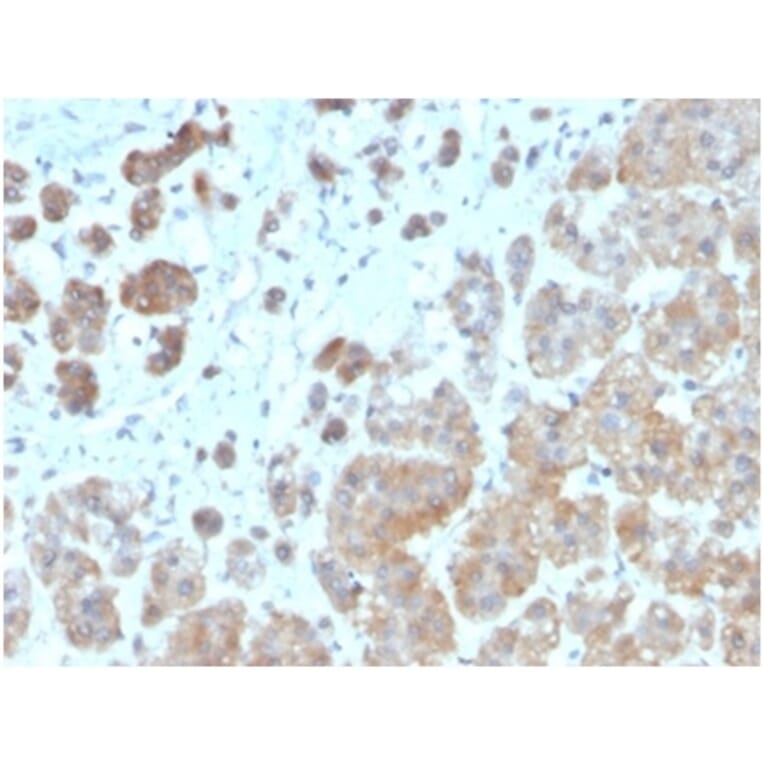 Immunohistochemistry - Anti-IL-1 beta Antibody [IL1B/3993] - BSA and Azide free (A278251) - Antibodies.com