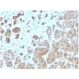 Immunohistochemistry - Anti-IL-1 beta Antibody [IL1B/3993] - BSA and Azide free (A278251) - Antibodies.com