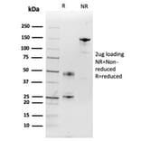 SDS-PAGE - Anti-IL-2 Antibody [IL2/3949] - BSA and Azide free (A278253) - Antibodies.com