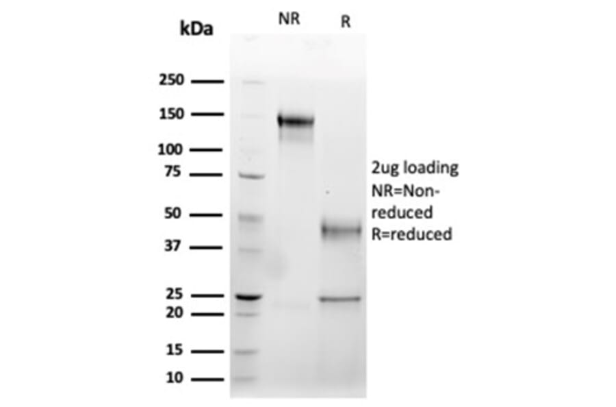 SDS-PAGE - Anti-Fas Ligand Antibody [FASLG/4456] - BSA and Azide free (A278256) - Antibodies.com