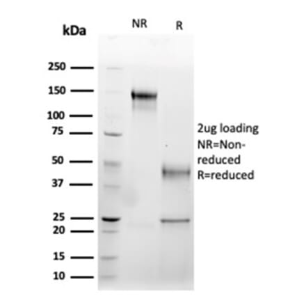 SDS-PAGE - Anti-Fas Ligand Antibody [FASLG/4456] - BSA and Azide free (A278256) - Antibodies.com