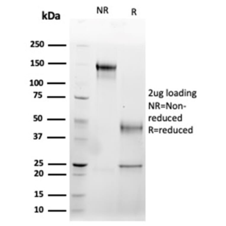 SDS-PAGE - Anti-Fas Ligand Antibody [FASLG/4456] - BSA and Azide free (A278256) - Antibodies.com