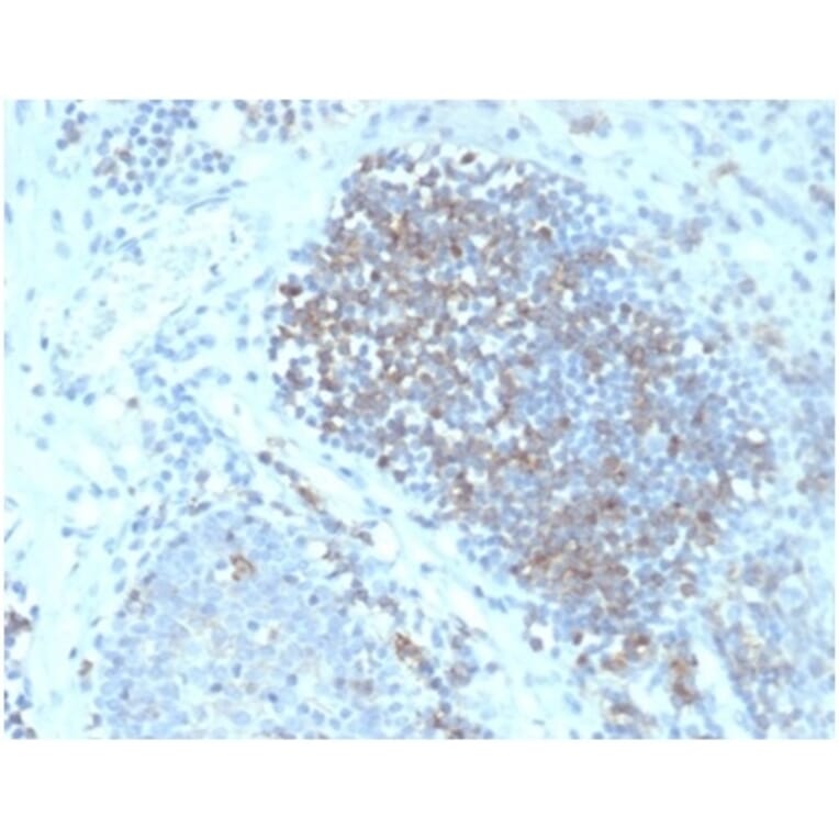 Immunohistochemistry - Anti-Fas Ligand Antibody [FASLG/4456] - BSA and Azide free (A278256) - Antibodies.com