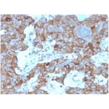 Immunohistochemistry - Anti-IL-3 Antibody [IL3/4004] - BSA and Azide free (A278257) - Antibodies.com