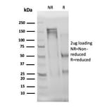 SDS-PAGE - Anti-IL-3 Antibody [IL3/4004] - BSA and Azide free (A278257) - Antibodies.com