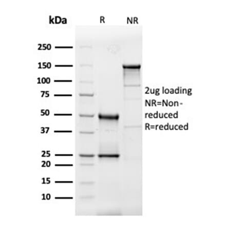 SDS-PAGE - Anti-IL-3 Antibody [IL3/4005] - BSA and Azide free (A278258) - Antibodies.com