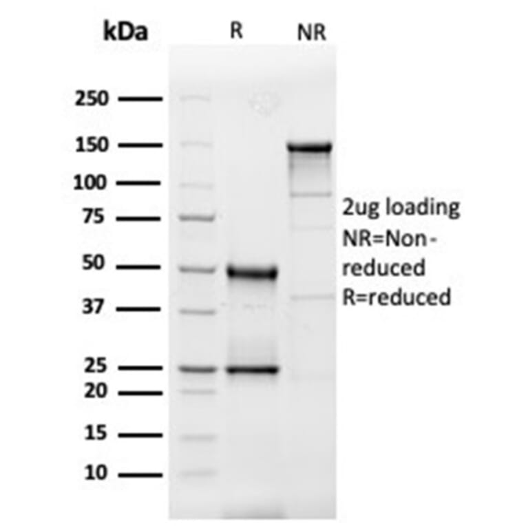 SDS-PAGE - Anti-IL-3 Antibody [IL3/4005] - BSA and Azide free (A278258) - Antibodies.com