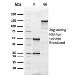 SDS-PAGE - Anti-IL-3 Antibody [IL3/4005] - BSA and Azide free (A278258) - Antibodies.com