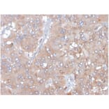 Immunohistochemistry - Anti-IL-5 Antibody [IL5/4161] - BSA and Azide free (A278259) - Antibodies.com