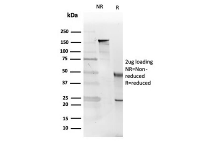 SDS-PAGE - Anti-IL-5 Antibody [IL5/4161] - BSA and Azide free (A278259) - Antibodies.com