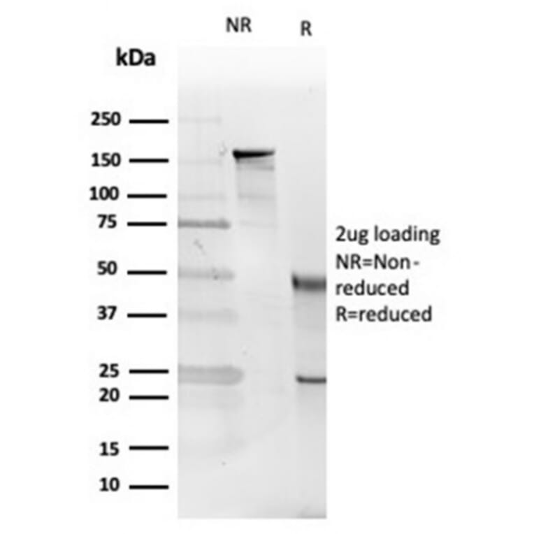 SDS-PAGE - Anti-IL-5 Antibody [IL5/4161] - BSA and Azide free (A278259) - Antibodies.com