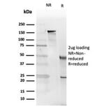 SDS-PAGE - Anti-IL-5 Antibody [IL5/4161] - BSA and Azide free (A278259) - Antibodies.com