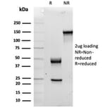 SDS-PAGE - Anti-IL-15 Antibody [IL15/4354] - BSA and Azide free (A278264) - Antibodies.com