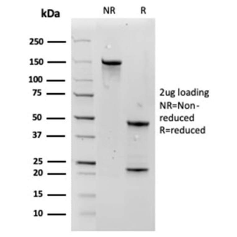 SDS-PAGE - Anti-Aquaporin 4 Antibody [AQP4/3324] - BSA and Azide free (A278266) - Antibodies.com