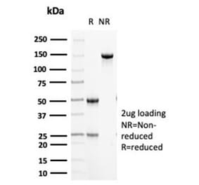 SDS-PAGE - Anti-Cytokeratin 5 Antibody [KRT5/6466] - BSA and Azide free (A278269) - Antibodies.com