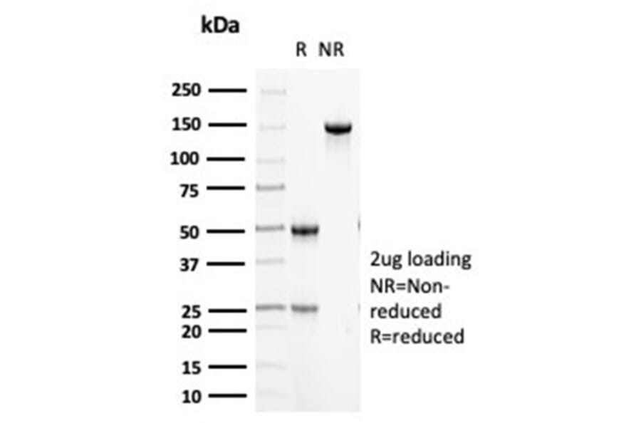 SDS-PAGE - Anti-Cytokeratin 5 Antibody [KRT5/6466] - BSA and Azide free (A278269) - Antibodies.com