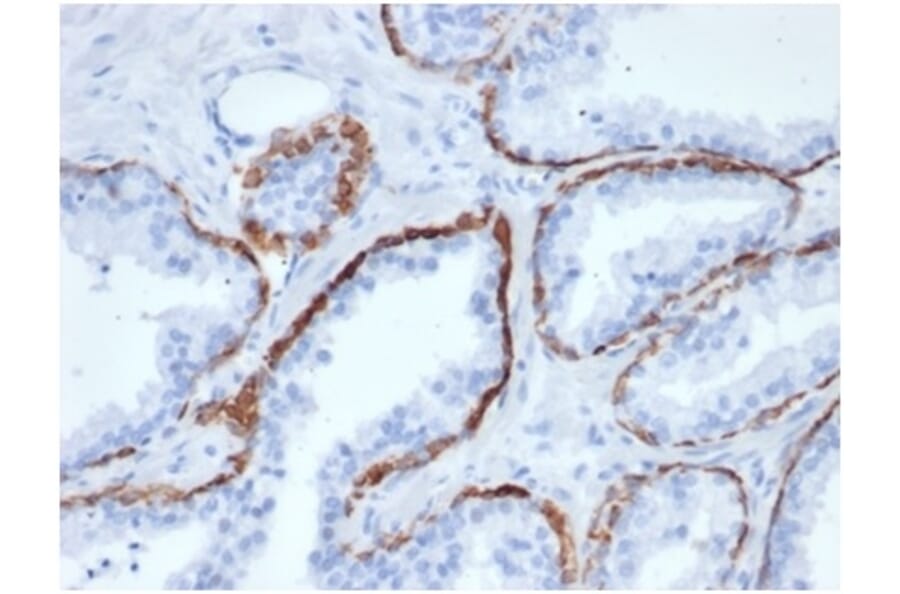 Immunohistochemistry - Anti-Cytokeratin 5 Antibody [KRT5/6466] - BSA and Azide free (A278269) - Antibodies.com
