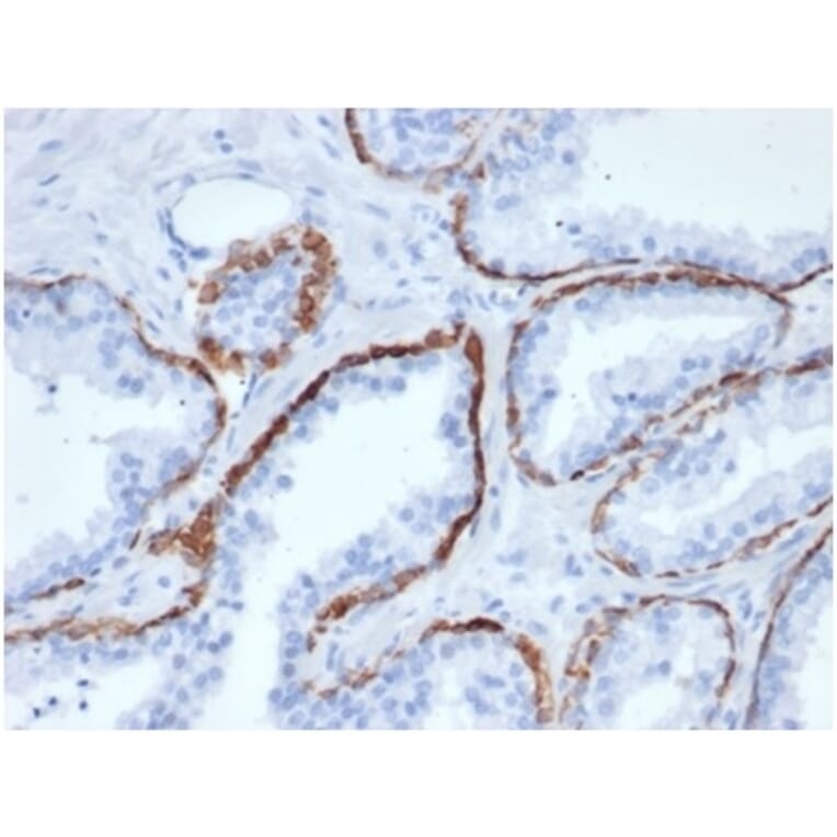 Immunohistochemistry - Anti-Cytokeratin 5 Antibody [KRT5/6466] - BSA and Azide free (A278269) - Antibodies.com