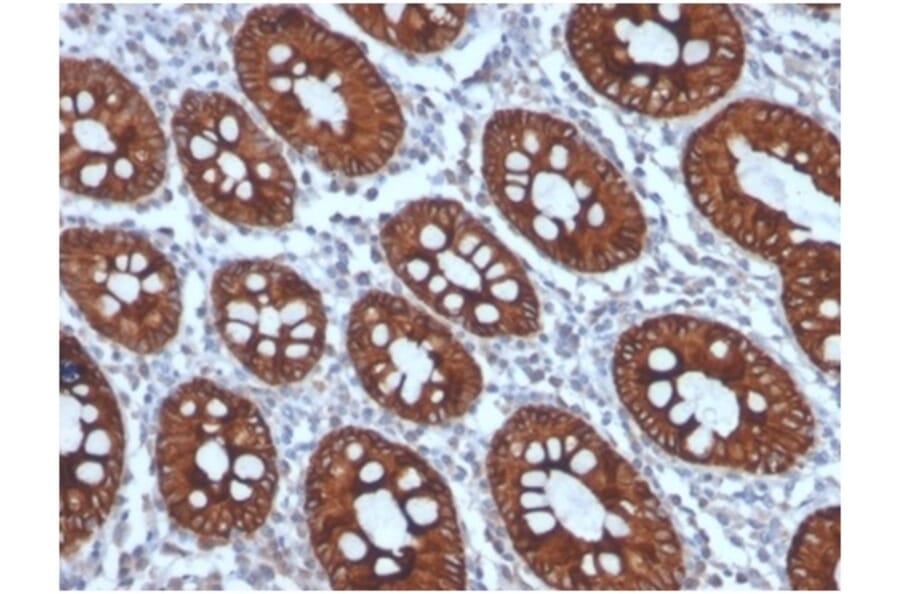 Immunohistochemistry - Anti-Cytokeratin 8 Antibody [KRT8/4006] - BSA and Azide free (A278270) - Antibodies.com