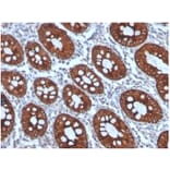 Immunohistochemistry - Anti-Cytokeratin 8 Antibody [KRT8/4006] - BSA and Azide free (A278270) - Antibodies.com