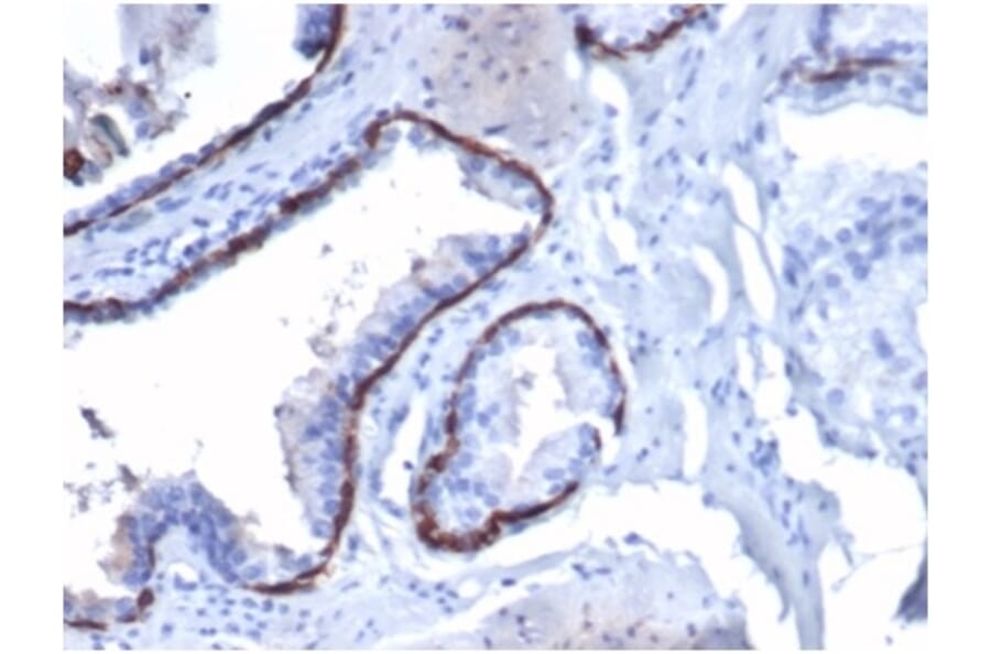 Immunohistochemistry - Anti-Cytokeratin 14 Antibody [KRT14/4130] - BSA and Azide free (A278271) - Antibodies.com