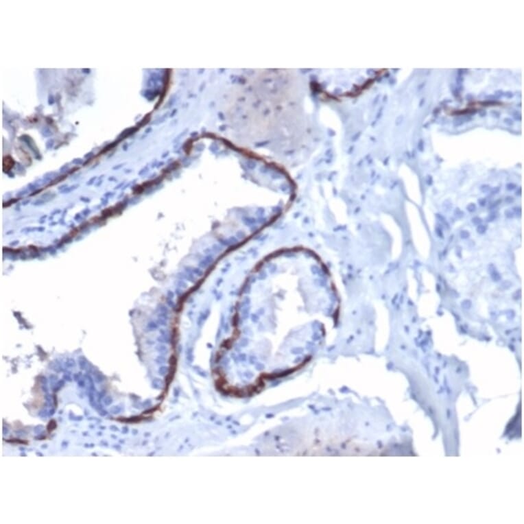 Immunohistochemistry - Anti-Cytokeratin 14 Antibody [KRT14/4130] - BSA and Azide free (A278271) - Antibodies.com