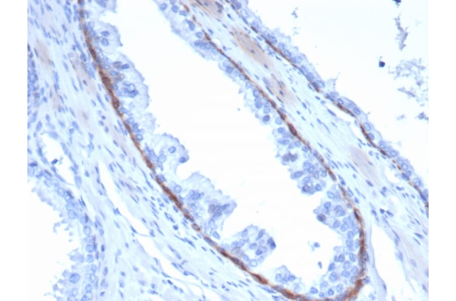 Immunohistochemistry - Anti-Cytokeratin 14 Antibody [KRT14/4132] - BSA and Azide free (A278272) - Antibodies.com