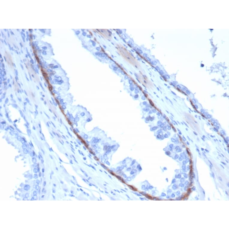 Immunohistochemistry - Anti-Cytokeratin 14 Antibody [KRT14/4132] - BSA and Azide free (A278272) - Antibodies.com