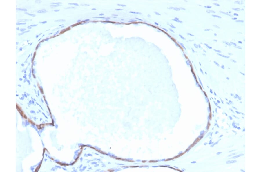 Immunohistochemistry - Anti-Cytokeratin 14 Antibody [KRT14/4132] - BSA and Azide free (A278272) - Antibodies.com