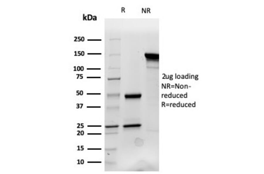 SDS-PAGE - Anti-Cytokeratin 14 Antibody [KRT14/4132] - BSA and Azide free (A278272) - Antibodies.com