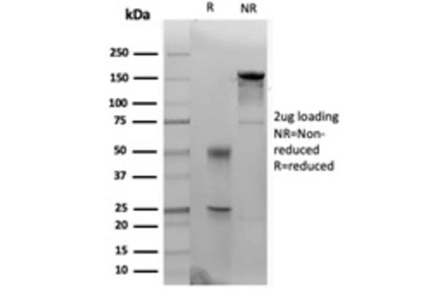 SDS-PAGE - Anti-Cytokeratin 14 Antibody [KRT14/4133] - BSA and Azide free (A278273) - Antibodies.com
