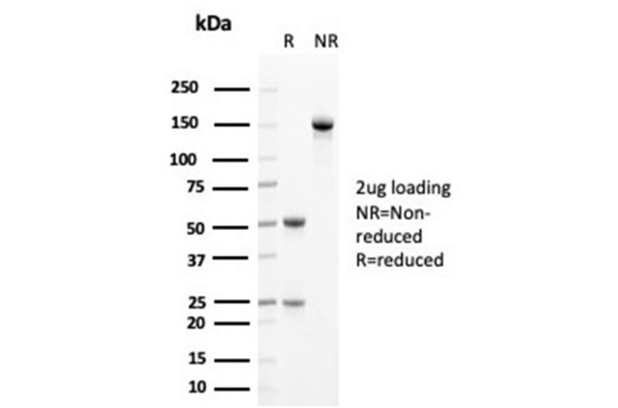 SDS-PAGE - Anti-Cytokeratin 14 Antibody [KRT14/4125] - BSA and Azide free (A278274) - Antibodies.com