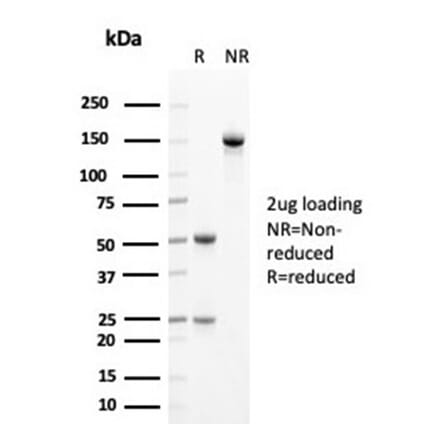 SDS-PAGE - Anti-Cytokeratin 14 Antibody [KRT14/4125] - BSA and Azide free (A278274) - Antibodies.com
