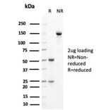 SDS-PAGE - Anti-Cytokeratin 14 Antibody [KRT14/4125] - BSA and Azide free (A278274) - Antibodies.com