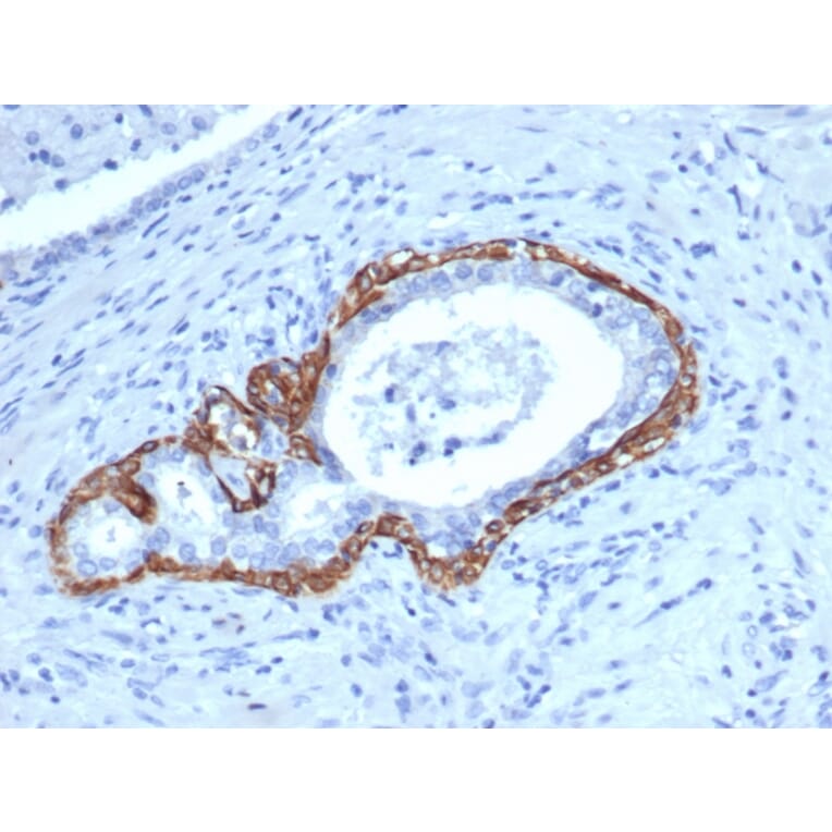 Immunohistochemistry - Anti-Cytokeratin 14 Antibody [KRT14/4129] - BSA and Azide free (A278275) - Antibodies.com